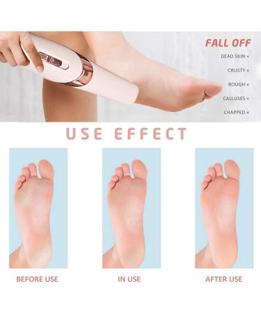 1 Piece Electric Foot Grinder Automatic Pedicure Tool Rechargeable Waterproof Hard Skin Remover with 2 Foot Grinders and 2 Cleaning Brushes for Calluses and Cracked Heels Foot Care - Buy Online on SooperMarket.com