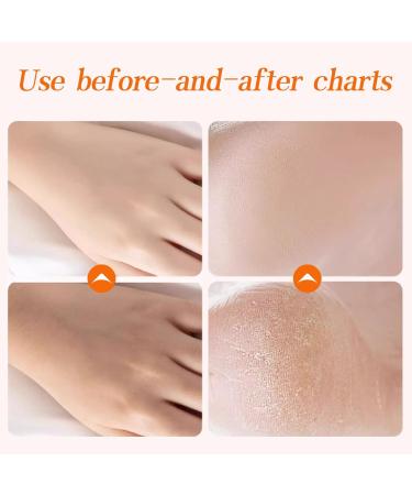 Gold Honey Hand Mask Wax | Hydrating & Nourishing Peel Off Handmask for Soft Skin - Buy Online on SooperMarket.com