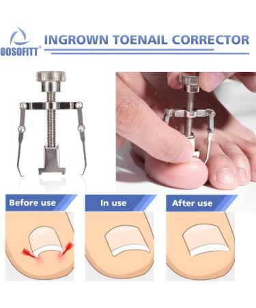 Ingrown Toenail Clippers Kit for Seniors/Adults by OOSOFITT - Wide Jaw Opening Nail Clipper for Thick Nails - Pedicure Tool for Ingrown/Thick Nails - Buy Online on SooperMarket.com