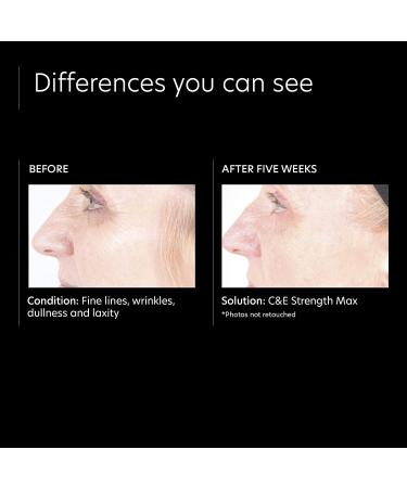 PCA Skin C&E Strength Max Antioxidant Corrective Cream - 1 Fl Oz - Anti-Aging Serum with Vitamin C & E for Brightening & Wrinkle Reduction - Buy Online on SooperMarket.com