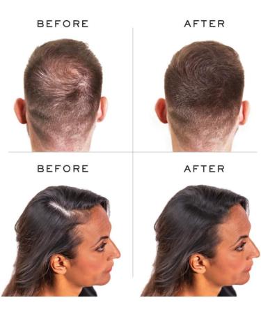Nanogen Hair Fibres 30g Grey - Instant Hair Thickening Solution - Buy Online on SooperMarket.com