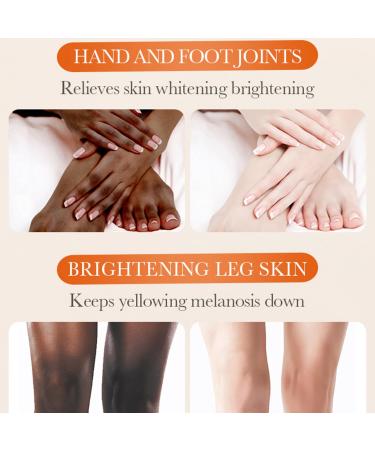 5.2oz Dark Knuckle Whitening Cream - Dark Spot Corrector for Knees Elbows & Neck - Moisturizing Skin Bleaching with Niacinamide & Vitamin C - Buy Online on SooperMarket.com