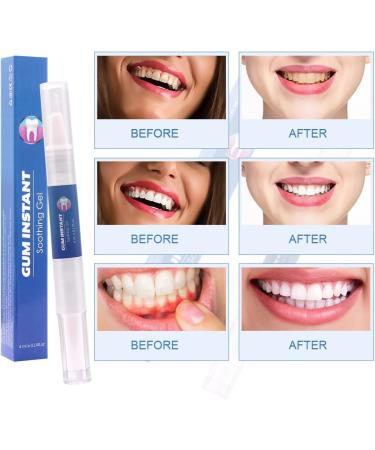 Fengyang 2PCs Gum Gel - Instant Gum Therapy & Restoration Gel for Healthy Gums | International Shipping Available - Buy Online on SooperMarket.com