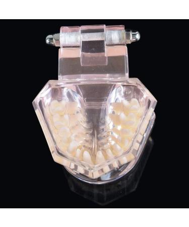 LBYLYH Orthodontic Demonstration Model - Teeth Teaching Tools with Metal & Ceramic Support for Effective Dental Treatment - Buy Online on SooperMarket.com