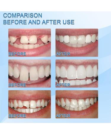 Tooth Repair Granules Temporary Tooth Repair Kit Tooth Repair Granules Dental Filling Restoration Kits Missing Broken Teeth Fillings Temporary Tooth Repair Kit Halloween Decorations 30ml*3 - Buy Online on SooperMarket.com