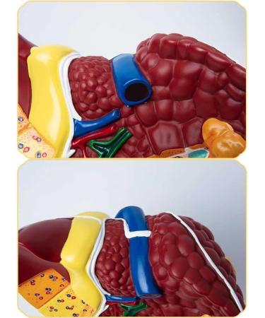 Teaching Model Human Liver Educational Model with Base and Clear Texture and Pathological Features Liver Cirrhosis Model for Medical School Study and Research - Buy Online on SooperMarket.com