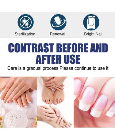 Buy Tlopa Nail Growth and Strengthening Serum - Nail Repair Solution (2 Pieces) for Stronger Healthier Nails Worldwide - Buy Online on SooperMarket.com