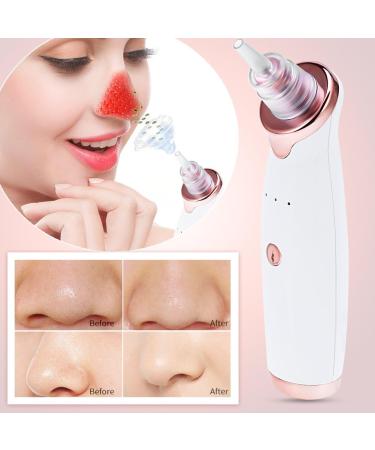 Blackhead Removal Device - Deep Cleansing for All Skin Types - Easy and Practical White Tool - Buy Online on SooperMarket.com