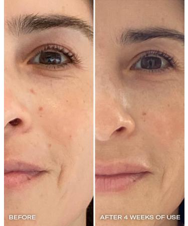 Then I Met You Ros Resurfacing Facial Mask - Nourishing AHA BHA Treatment | Vegan Brightening Skincare - Buy Online on SooperMarket.com