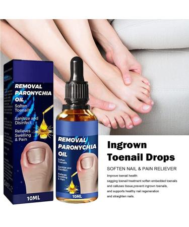 3Pcs German Toenailcare Removal Paronychia Oil for Healthier Toenails - Buy Online on SooperMarket.com