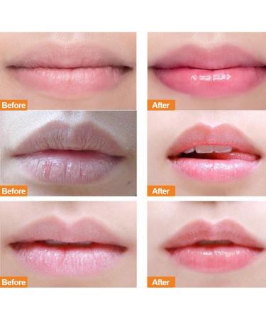 Peach Lip Scrub & Balm | Moisturizer for Dry Cracked Lips - Repair & Hydrate Your Smile - Buy Online on SooperMarket.com
