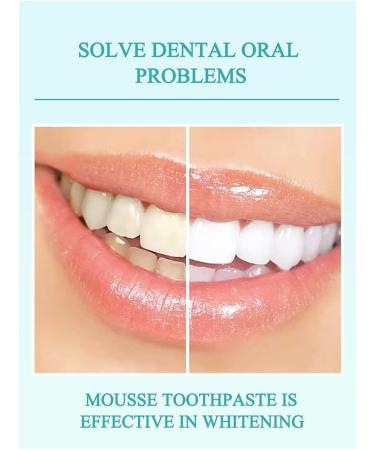 2 Pcs Mousse Mouthwash 50 ML - Deep Clean Stain Removal & Teeth Whitening Oral Care - Buy Online on SooperMarket.com