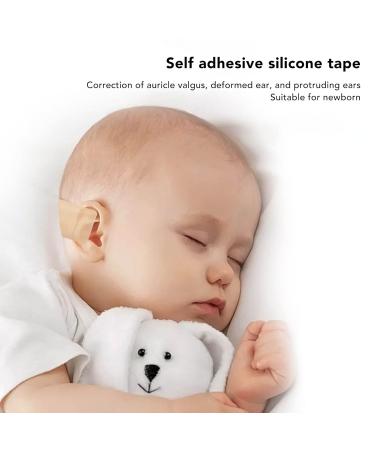 Anggrek Baby Auricle Valgus Correction Patch - Professional Silicone Infant Ear Aesthetic Corrector - Buy Online on SooperMarket.com