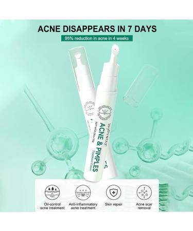 Anti-Acne Face Cream Spot Cream for Acne Treatment and Spot Treatment Skin Treatment Gel Cream For Face Blemishes & Blackheads Acne Treatment Cream Anti Acne Spot - Buy Online on SooperMarket.com