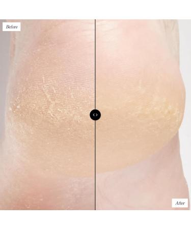 Beekman 1802 Sunshine Body Scrub - Fragrance Free 8 oz | Exfoliate Keratosis Pilaris | Gentle PHA Body Scrub for Sensitive Skin | Cruelty Free - Buy Online on SooperMarket.com