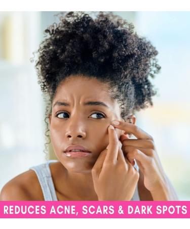 Demure Sulphur & Salicylic Acid Exfoliating Soap Bar | Reduces Acne, Soothes, Moisturizes, Softens Skin | Anti-Blemish Formula - Buy Online on SooperMarket.com