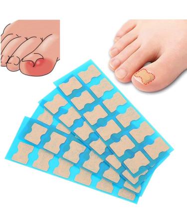 Ingrown Toenail Patch Pedicure Sticker Ingrown Toenail Correction Patch Foot Care Pedicure Sticker Toenail Treatment Tool (48 pieces) - Buy Online on SooperMarket.com