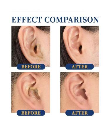 Ear Ringing Relief Drops 10ml - Treat Deafness, Tinnitus, Itching, and Earache - Natural Health Oil for Hearing Care - Buy Online on SooperMarket.com