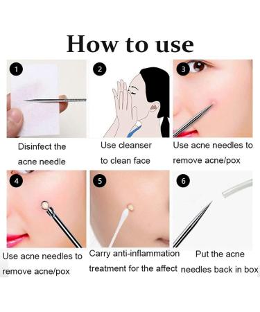 U-K Newest Dual Heads Acne Needle Blackhead Blemish Squeeze Pimple Extractor Remover Spot Cleaner Beauty Skin Care Tool 4pcs/set - Buy Online on SooperMarket.com