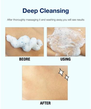 Epielle Charcoal Exfoliating Scrub 2pk - Deep Clean Pores Exfoliate & Smooth Skin - International Shipping Available - Buy Online on SooperMarket.com