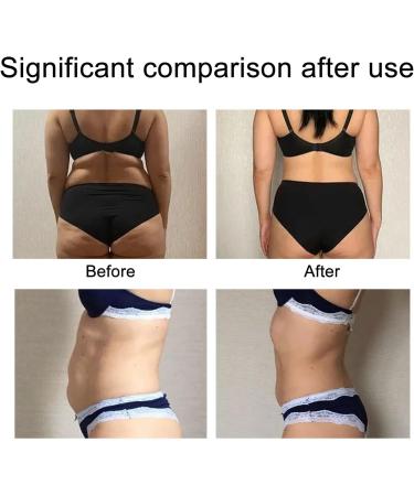 Anggrek Body Lipo Patch: Abdomen Lift Tapes for Firming, Slimming & Cellulite Reduction - Buy Online on SooperMarket.com