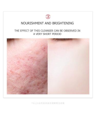 VENZEN Nicotinamide Hydrating Moisturizing Cleanser - Natural Essence Beauty Skin 80g | International Shipping - Buy Online on SooperMarket.com