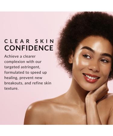 Double O Complex Astringent by Flori Roberts | 20% Salicylic Acid Acne Treatment | Clear Blemishes & Cleanse Pimples - International Shipping Available - Buy Online on SooperMarket.com