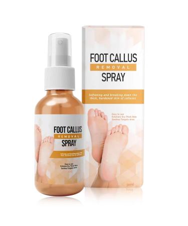 Tongyend Foot Peeling Spray Instant Foot Peeling Spray Foot Callus Removal Spray Moisturizing Hydrating Nourish Peel off Spray Foot Exfoliating Spray Remove Foot Dead Skin-30ML FootCallusRemover