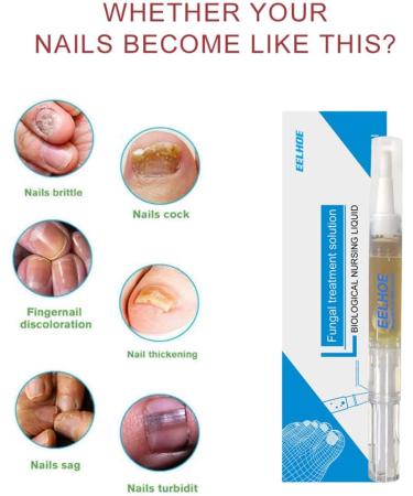 Okita Toenail Fungus Treatment Pen - Effective Nail Repair for Healthy and Strong Nails (5Pcs) - Buy Online on SooperMarket.com