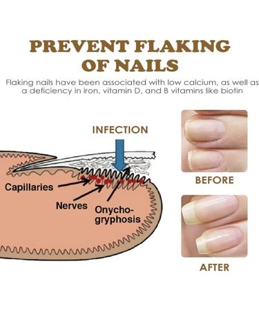 NailGrowth DeepHealing Organic Serum NailGrowth Nail Serum Reconstrux Nail Growth Nail Growth and Strengthening Serum Nail Serum for Growth and Repair for Damaged Nails (3pcs) - Buy Online on SooperMarket.com