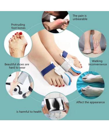 Kenanlan Bunion Corrector for Women - 2PC Toe Splints & Separators for Overlapping Big Toe - Universal Size - Buy Online on SooperMarket.com
