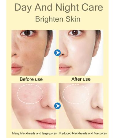 Gentle Acne Serum for Face Acne Treatment Essence Relief Pimple Pigmentation Blackhead Brighten Shrink Smooth Skin Redness Relief Face Acne Spot Treatment Repair Skin for Acne Skin - Buy Online on SooperMarket.com