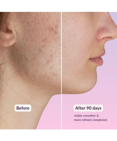 High Strength Retinol Serum - 2 5% Retinol Anti-Ageing Formula with Hyaluronic Acid and Witch Hazel - 30ml - Intensive Face Care against Wrinkles and Age Spots - Buy Online on SooperMarket.com