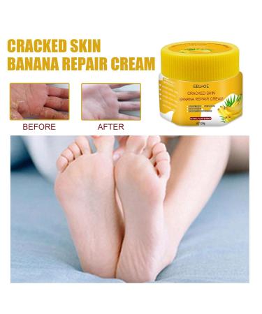 Foot Care Moisturizing Cream - Regenerating Formula for Cracked Feet - Fast Absorbing & Intensive Hydration - 1g Pack (Yellow) - Buy Online on SooperMarket.com