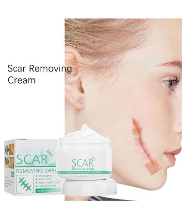 Jopwkuin Scar Removal Cream - Reduce Wrinkles & Soothe Surgery Scars - For Men - Buy Online on SooperMarket.com