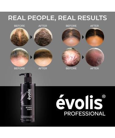 Volis Reverse Hair Growth Shampoo with Keratin & Wheat Protein - Sulfate-Free Treatment (8.5 fl oz) - Buy Online on SooperMarket.com