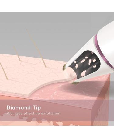 HoMedics Radiance Microdermabrasion Rose Gold - Professional Quality Salon Grade Deep Skin Exfoliation at Home Fast Treatment for Normal + Sensitive Skin Diminish Wrinkles Revitalise Skin HoMedics Radiance Microdermabrasion Rose Gold Professional Quality  - Buy Online on SooperMarket.com