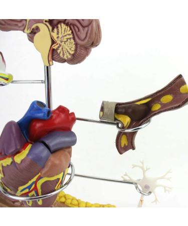 Model Model of Diabetes Complications Heart Pancreas Brain Neuron Model Foot Medical Communication Aids for The Diabetes Demonstration - Buy Online on SooperMarket.com