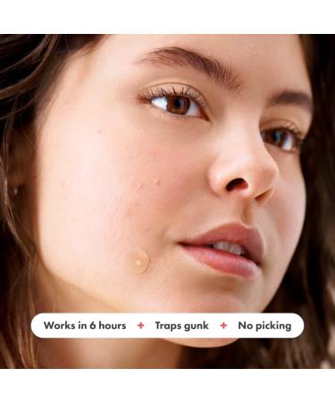 Mighty Patch Original from Hero Cosmetics - Medical-grade Hydrocolloid Pimple Patch Nightime blemish patch wake up to clearer looking skin suitable for sensitive skin (36 Count) - Buy Online on SooperMarket.com