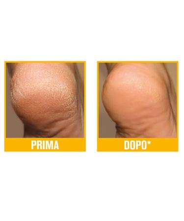 3 x Podovis Cream - Double Effect for Corns Prevention Moisturizing & Smoothing - Dermatologically Tested - 180g (3 Bottles of 60ml) - International Shipping Available - Buy Online on SooperMarket.com