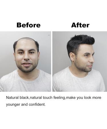 Natural Black Men's Hair Piece - Thin Skin Toupee for Male Receding Hairline (13cmx14cm) - Buy Online on SooperMarket.com