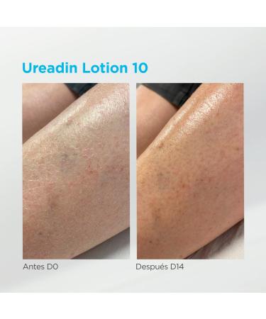 ISDIN Ureadin Lotion 10 (1000ml) Intensive Moisturizing Body Lotion for Dry Skin with 10% Urea | 1 Liter Pack - International Shipping Available - Buy Online on SooperMarket.com
