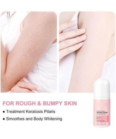 Keratosis Pilaris Cream Chicken Skin Care Cream Skin Exfoliating Repair Cream Keratosis Pilaris Treatment Legs Treatment Body Cream Rough Skin Cream For Rough And Bumpy Dry Skin 50g - Buy Online on SooperMarket.com