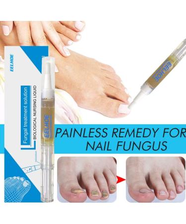 Okita Toenail Fungus Treatment Pen - Effective Nail Repair for Healthy and Strong Nails (5Pcs) - Buy Online on SooperMarket.com