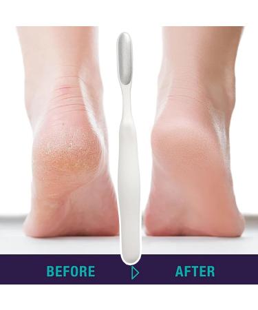 Toseky Foot Rasp Foot File - Reusable Stainless Steel Cracked Skin Removal Tool | Foot File Foot ScrubberStainless Steel Cracked Skin Removal File Brush Tools for Foot Scrubbing White - Buy Online on SooperMarket.com