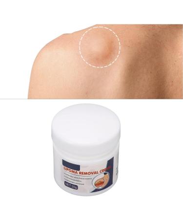 Lipoma Removal Cream 0.7oz | Anti-Inflammatory Cellulite Treatment for Skin | Easy Absorption Formula | Alleviate Lipoma Mass - Buy Online on SooperMarket.com