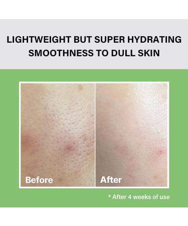 Celimax Noni Moisture Balancing Toner 150ml - Hydrating & Soothing with 80.1% Noni Extract - Anti-Aging Solution for Acne, Dark Spots, Fine Lines - Korean Skincare, Dermatologist Tested - Buy Online on SooperMarket.com
