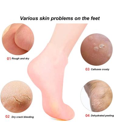 Buy Moisturizing Gel Socks for Nourishing Foot Care | Angrek Highly Elastic Ankle Boots - Reduce Wrinkles & Hydrate - Buy Online on SooperMarket.com