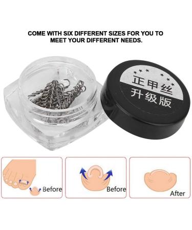 Ingrown Toe Wire Fixer 2 Box Fixer Toenail Correction Corrector Lifter Tool Nail Ingrowing Pedicure Care with 6 Sizes for Nail Toe Straighteners Recover Foot Care Men and Women - Buy Online on SooperMarket.com