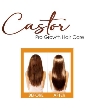 Buy Difeel Essentials Pro-Growth Castor Hair Mist 6 oz | Nourish & Strengthen Hair | Fast International Shipping - Buy Online on SooperMarket.com